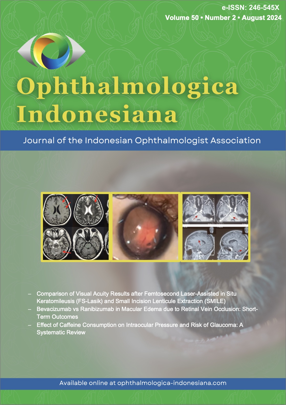 					View Vol. 50 No. 2 (2024): Ophthalmologica Indonesiana
				