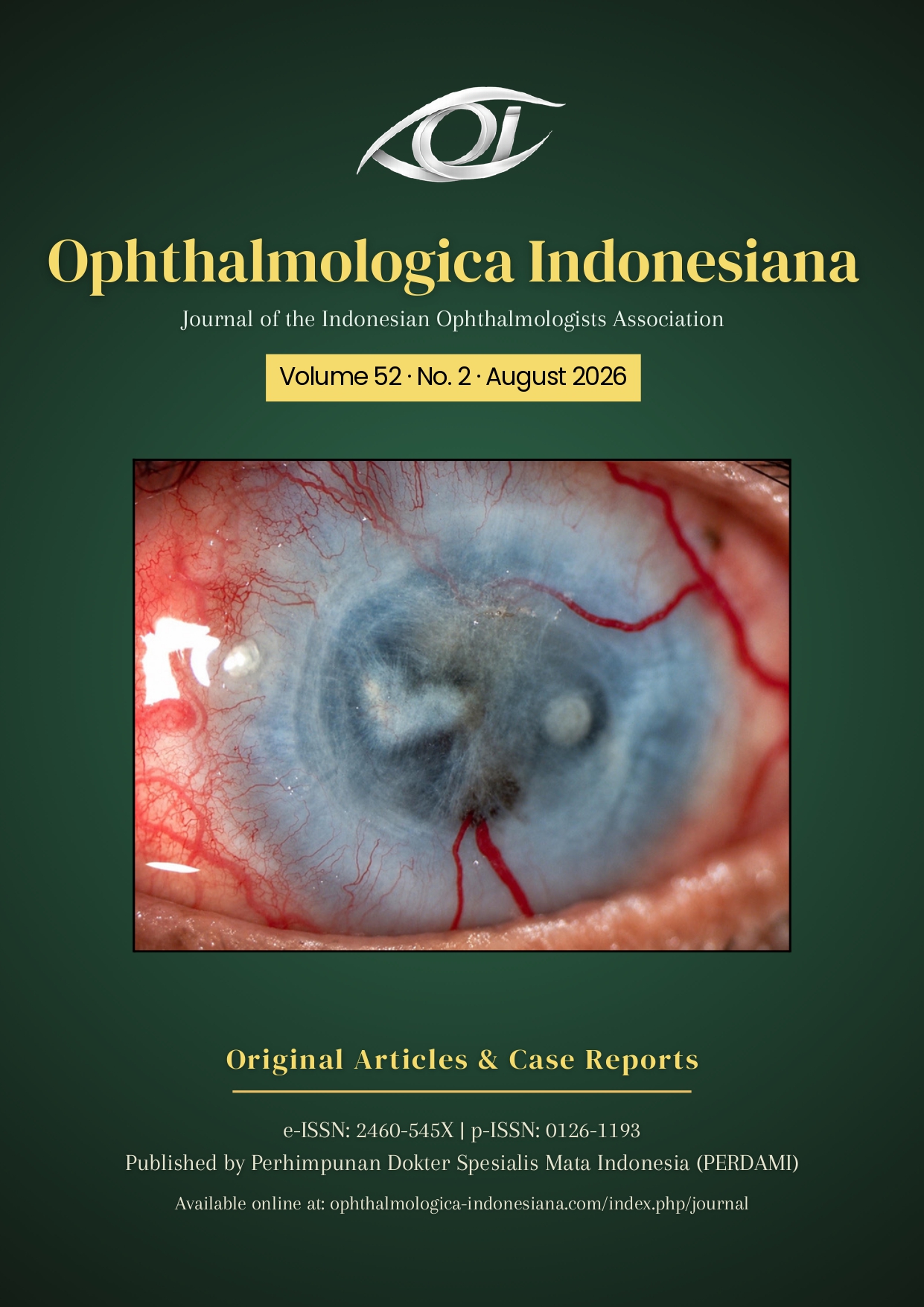  View Vol. 52 No. 2 (2026): Ophthalmologica Indonesiana  